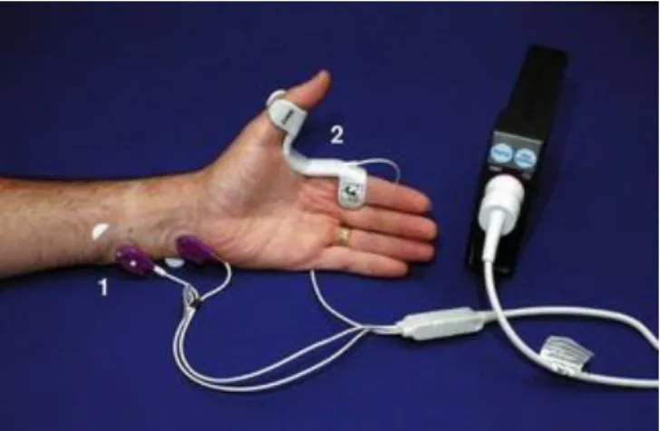 Figure  1.10  -  Datex–Ohmeda  M-NMT  neuromuscular  transmission  module  with  kinemyographic  mechanosensor