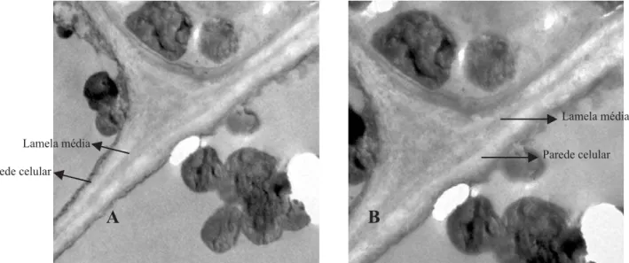 Figura 1. Eletromicrografias de transmissão da parede celular de frutos de goiabeira, de pomares que receberam aplicação de cálcio