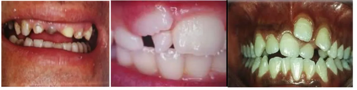 Figura 5 – Exemplos de anomalias dentárias 