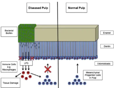 Figura 6 - Contraste entre polpa normal e polpa afetada (adaptado de Colombo et al., 2014).