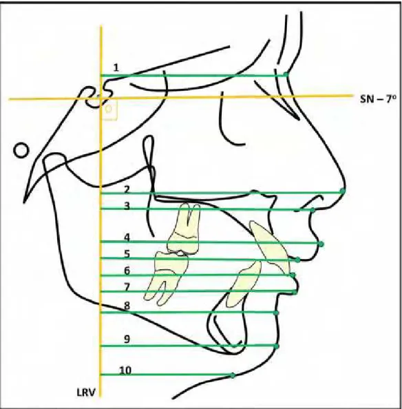 FIGURA 7 - Medidas anteroposteriores do perfil tegumentar. 