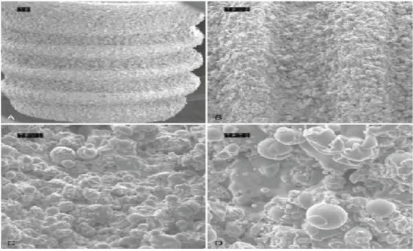 Figure 6:  Scanning electron microscope (SEM) image of titanium plasma–sprayed surface implant   with   rough   surface   characteristics