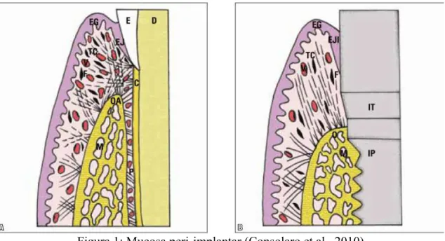 Figura 1: Mucosa peri-implantar (Consolaro et al., 2010) 