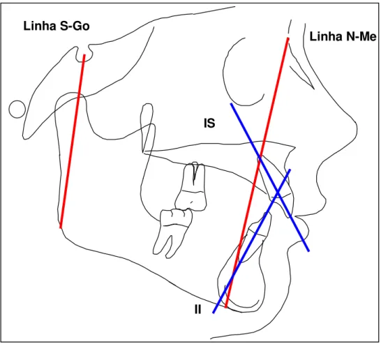 FIGURA 4 - Linhas cefalométricas Linha S-Go 