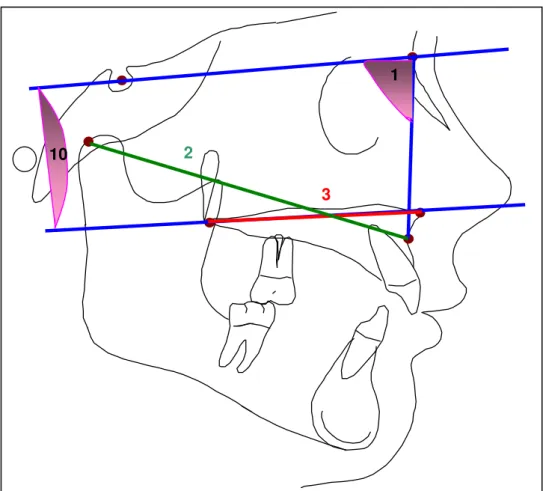 FIGURA 5 - Medidas de Crescimento Maxilar 