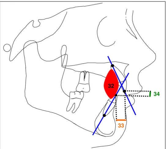 FIGURA 12 - Medidas de Desenvolvimento Dento-alveolar  (Relação Interincisivos)     34 33 32 