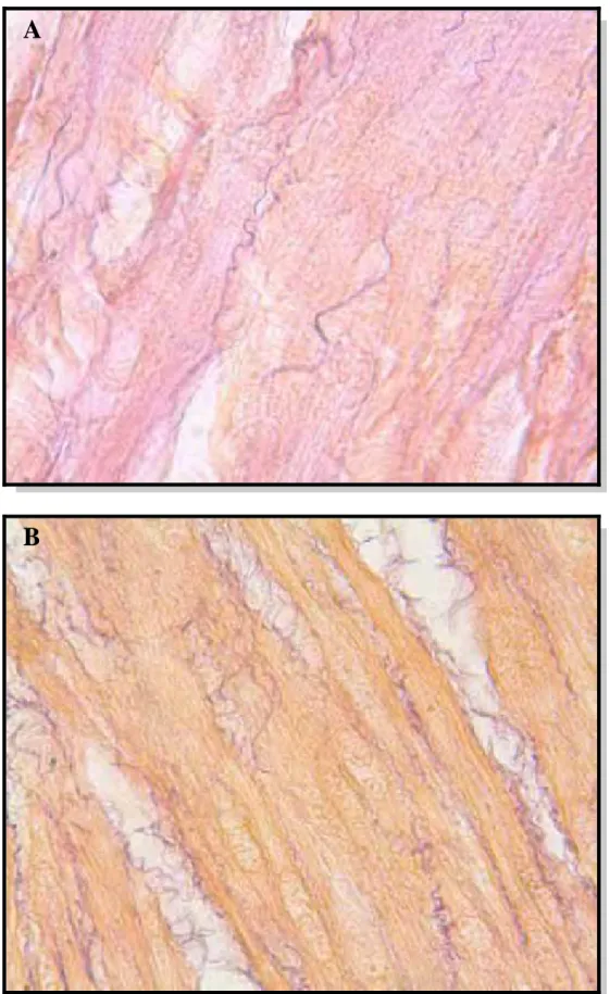 Figure 3: Weigert’s Fuchsin- Resorcin staining of the detrusor demonstrating the  amount of elastic fibers in control group (A) and animals with partial  bladder  outlet obstruction (grupo GII) (B), x1000