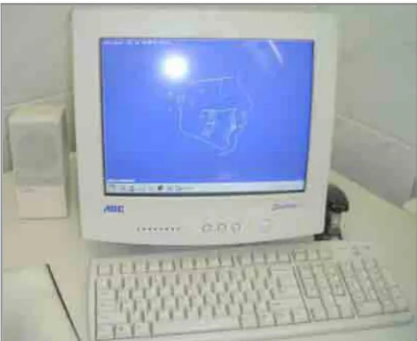 FIGURA 1A – Computador com análise utilizada.    
