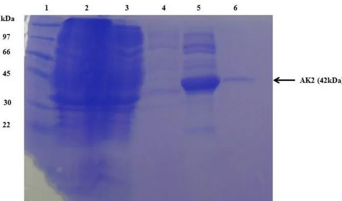 Figura 12 - Análise da purificação da AK2 em gel de poliacrilamida 15% corado com  Comassie Blue
