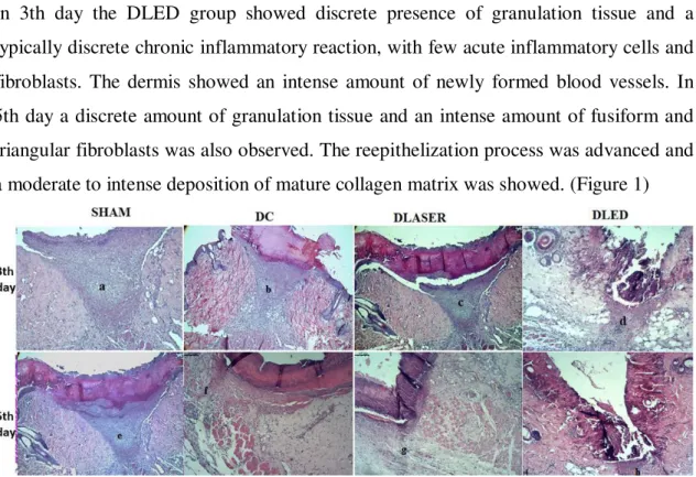 Figure . 2 comparative slides on 3 th and 5th day post treatment. On 3  th  day showing a moderate inflammatory  infiltrate  lymphocytic  and  a  discrete  granulation  tissue  (a),  an  intense  inflammatory  infiltrate  lymphocytic  and  a  discrete  gra