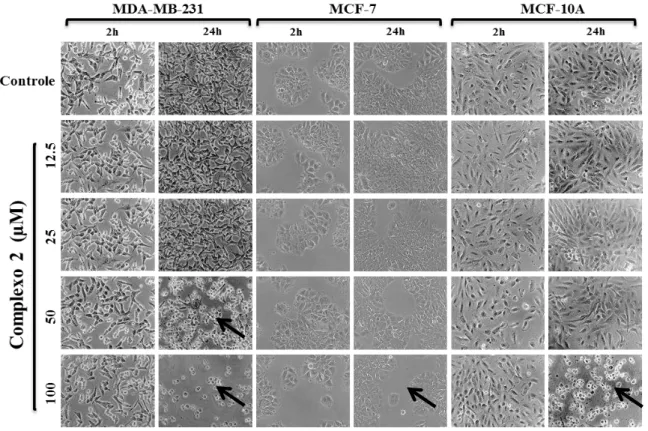 Figura 8 - Efeito do complexo (2) na morfologia das células tumorais de mama MDA-MB-231, MCF - 7 e  não tumorais de mama MCF-10A