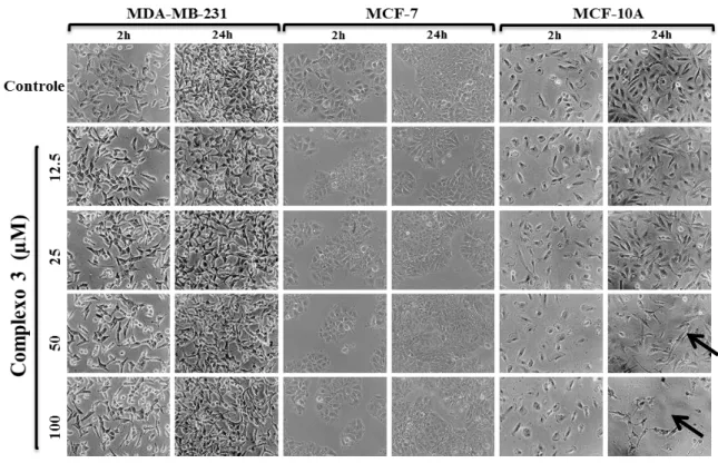 Figura 9 - Efeito do complexo (3) na morfologia das células tumorais de mama MDA-MB-231, MCF - 7 e  não tumorais de  mama  MCF-10A