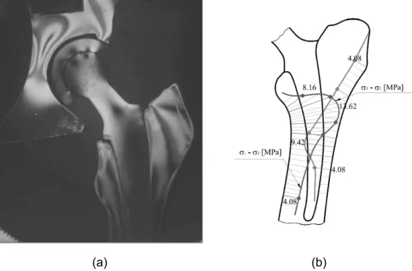 Figura 2.20 Análise fotoelástica de tensões obtida em modelo de epóxi: (a)  franjas isocromáticas no tecido ósseo e (b) diferença entre as tensões 