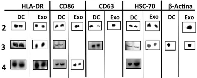 Figura  6.  Análise  Imunofenotípica  dos  Exossomos  e  das  DCs  por  Western  Blot