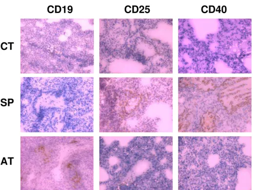 Figura 8. Detecção de células positivas para os marcadores CD19, CD25 e CD40 em cortes de  pulmão  de  camundongos  BALB/c  infectados  por  S