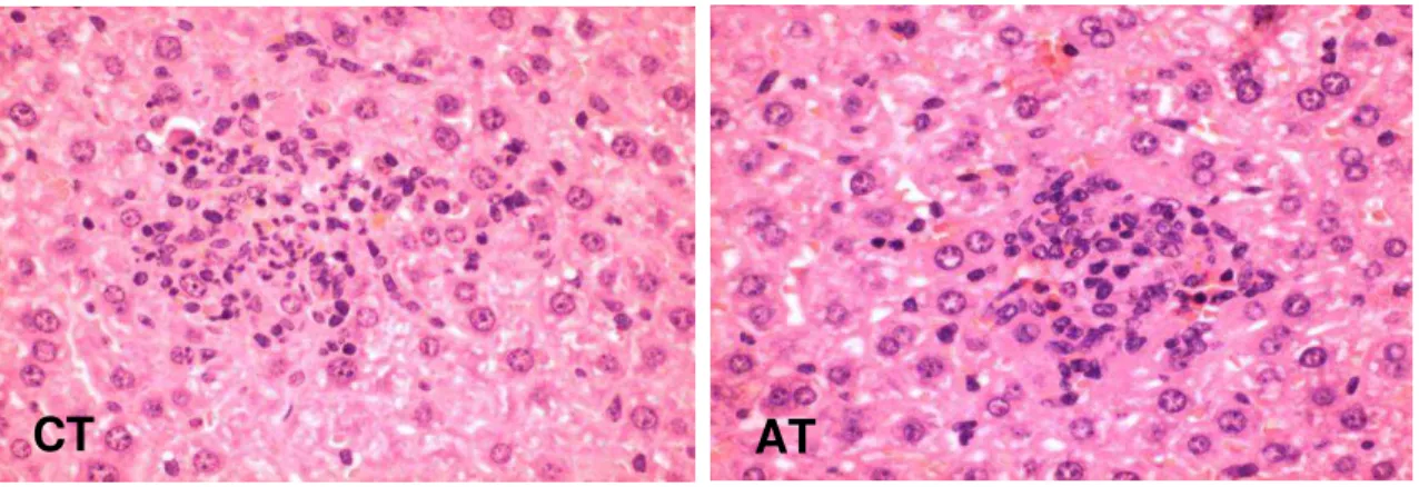Figura  10.  Formação  de  granulomas  no  fígado  de  camundongos  infectados.  Fotomicrografia  demonstrando  granulomas  formados  no  parênquima  hepático  de  camundongos  dos  grupos  CT  e  AT  após  infecção  por  S
