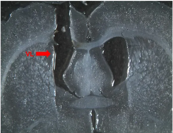 Figura 8: Fotomicrografia de um corte histológico do cérebro de um animal, indicando  (seta) o local de injeção no ventrículo lateral (VL)