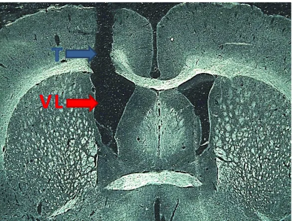 Figura 8: Fotomicrografia a fresco de corte histológico transversal de encéfalo de rato indicando pela  seta vermelha o ventrículo lateral (VL) e a pela seta azul a trajetória (T) da cânula guia
