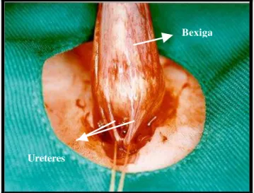 Figura 3: Foto demonstrando a implantação dos ureteres. 