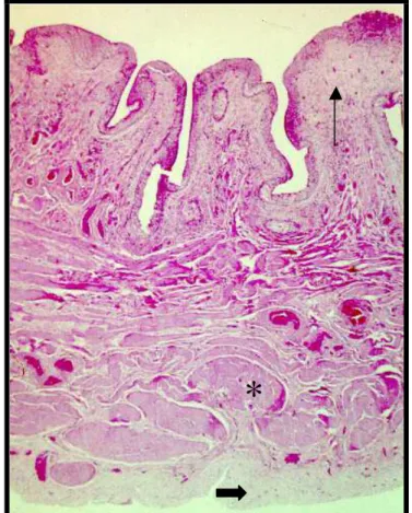 Figura  10: Corte Histológico da bexiga de coelho com obstrução (G2).  Nota-se área de  fibrose de submucosa leve (seta), fibrose  adventicial intensa (seta larga) e hipertrofia de músculo  intensa (asterisco)