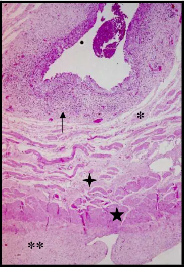 Figura  11: Corte histológico de bexiga de coelho com obstrução (G2).  Nota-se presença de reação inflamatória intensa (seta),  fibrose de submucosa (*) e adventícia (**)