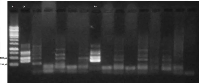 Figura 5: Gel de Agarose 1% apresentando amostra positiva para Anaplasma phagocytophilum