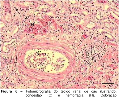 Figura 6  –  Fotomicrografia do tecido renal de cão ilustrando,  congestão (C) e hemorragia (H)