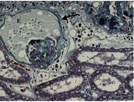 Figura 10  –  Fotomicrografia do tecido renal de cão ilustrando edema  glomerular (E), infiltrado mononuclear ao redor do  glomérulo (I) e espessamento de cápsula glomerular  (seta)