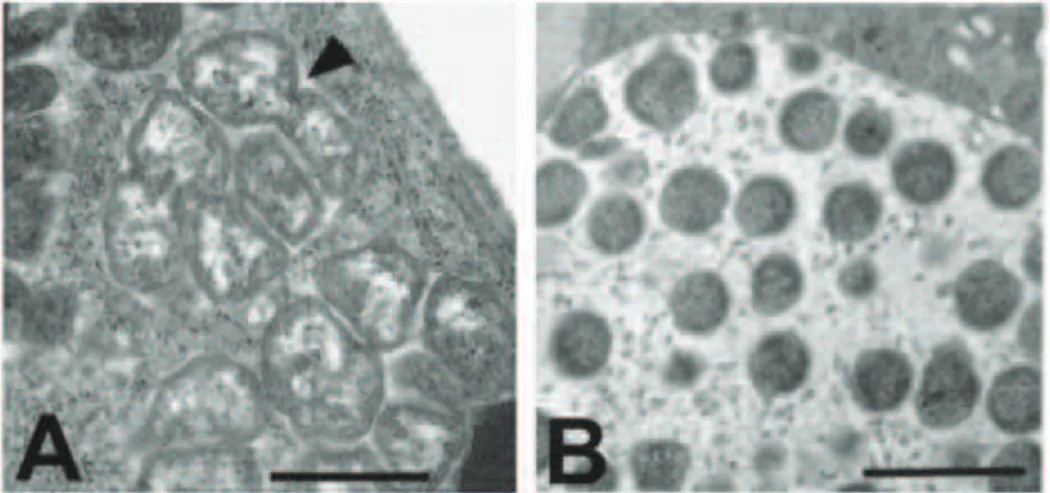 Figura 2. Microscopia eletrônica das duas fases de desenvolvimento do  Anaplasma marginale  em colônias de células infectadas de carrapatos