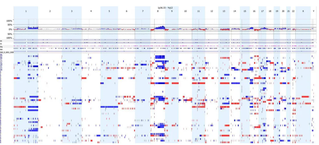 Figura 1 - Ideograma ilustrando as alterações genômicas encontradas nos 53 casos de CDI avaliados pela técnica de CGH-array