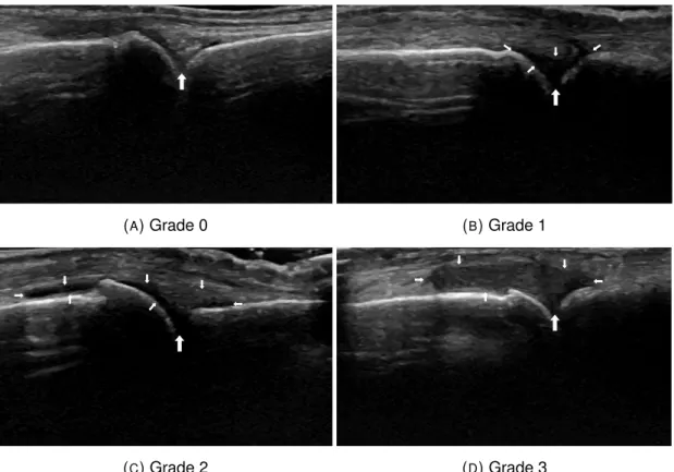 Fig. 7.1, gives an idea of the shape variability of the joint capsule. From Fig. 7.1- 7.1-A to Fig