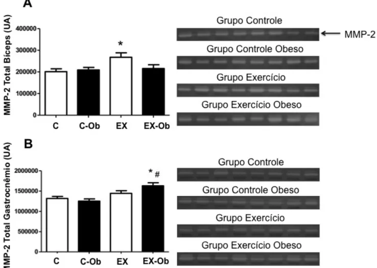 Figura  8:  Efeito  do  treinamento  resistido  e  da  dieta  hiperlipídica  na  atividade  da  metaloproteinases  2  (MMP-2), A: atividade total da MMP-2 (soma das formas pró, intermediária e ativa) no músculo bíceps  e gastrocnêmio