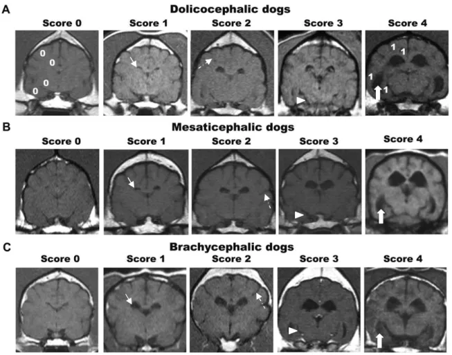 Figura 1. Imagens de ressonância magnética do parênquima cerebral de cães com diferentes  conformações  cranianas  (A-dolicocefálicos,  B-mesaticefálicos  e  C-braquicefálicos)  na  sequência  T1-weighted,  ilustrando  a  dilatação  ventricular  (seta  con