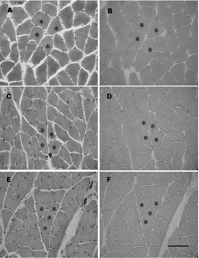 Figura 2 – Cortes transversais seriados do músculo sóleo corado com Azul de  Toluidina (A, C e E) e submetido à reação de Fosfatase àcida (B, D e F)