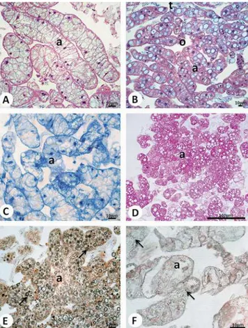 Figure 5. Histological sections of R. padbergi’s parietal fat body stained with ~A, B! H-E and submitted to the ~C! bromophenol blue, ~D! PAS, ~E! von Kossa, and ~F! sudan black techniques