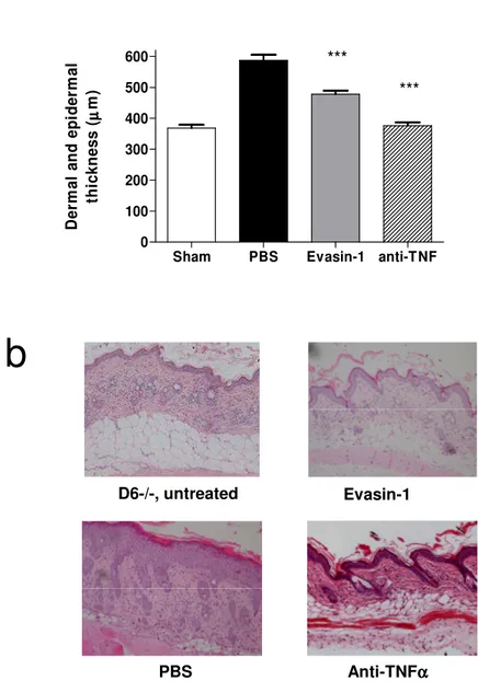 Fig 4 a D6-/-, untreated Evasin-1 Anti-TNFα αααPBSb