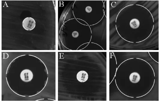 Fig.  9.  AIA's  readings  for  oddity  images.  (A)  AIA's  reading  even  with  noise  and  background