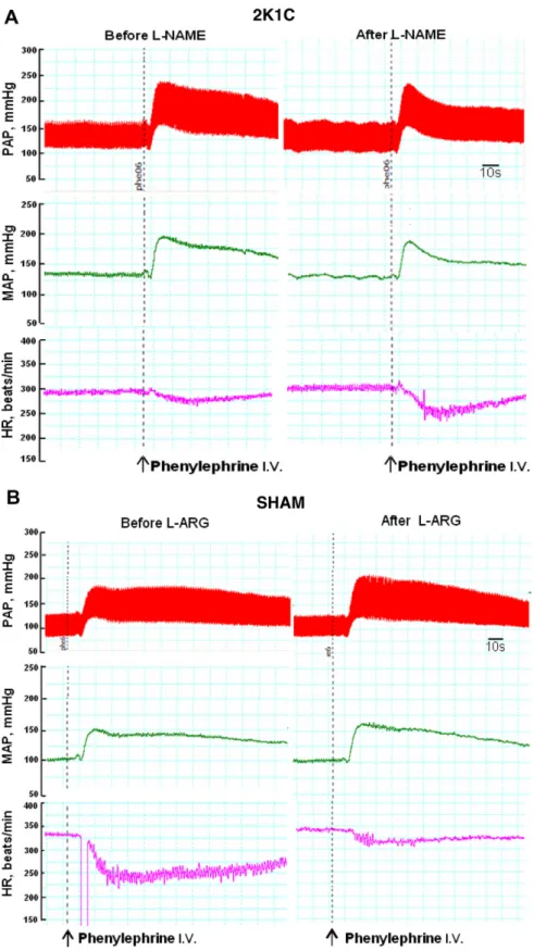 Fig. 4. Pulsatile (PAP, mmHg), mean arterial pressure (MAP, mmHg) and heart rate (HR, beats/min) recordings illustrating the typical effect produced by injection of phenylephrine (25 l g, i.v.) before and after CVLM microinjection of L -NAME (10 nmol) in 2