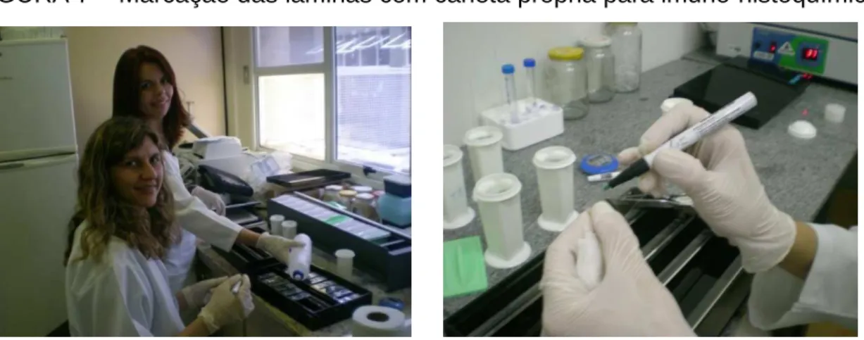 FIGURA 7 – Marcação das lâminas com caneta própria para imuno-histoquímica 