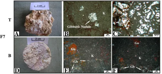 Fig. 8. A: Macroscopic view of F7 (top of the proﬁle); B: OMP (crossed polarised light) of F7 indicating a gibbsitic nodule involved with kaolinite ﬁne material with ﬂow zones of Fe;