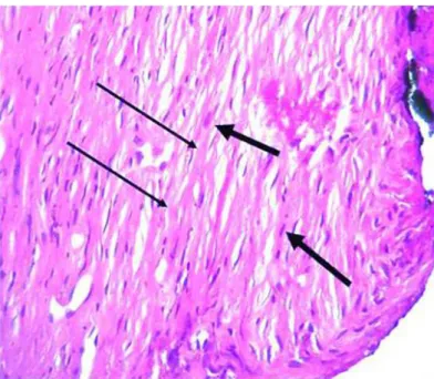 FIGURE 4 - Photomicrographs obtained for histologic evaluation (100X magnification). Sagittal sections of rats maxillary region, showing intense osteblastic activity (large arrow), woven bone within the alveolar gap (small arrow)