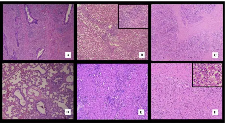 Figura 2: Lesões histopatológicas da circovirose. A, Tonsila - Depleção linfóide moderada, HE, 100X; B, Fígado - Hepatite peri-portal, HE, 100X;  C, Baço - Depleção linfóide intensa, histiocitose e células gigantes multinucleadas, HE, 100X; D, Pulmão - Pne