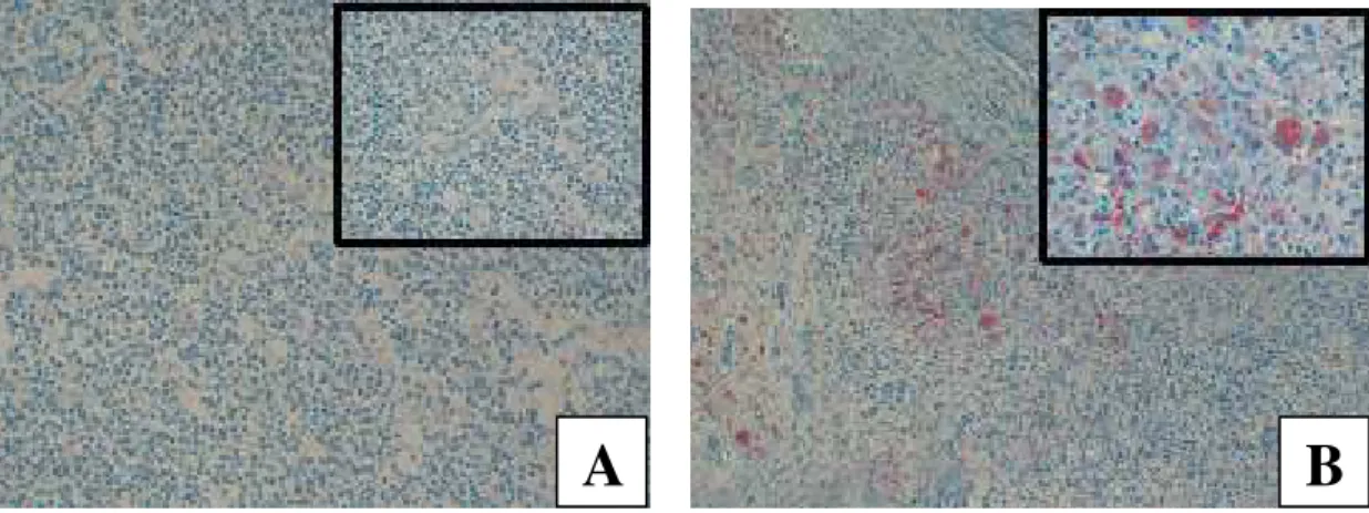 Figura  3:  Linfonodo:  Circovirose  suína  –  Imuno-histoquímica.  A  –  Observa-se  marcação  negativa,  100X (no detalhe, 200X) –  Macho do Grupo Vacinado; B - Observa-se marcação positiva vermelha em  células infectadas, 100X (no detalhe, 200X) –  Mach
