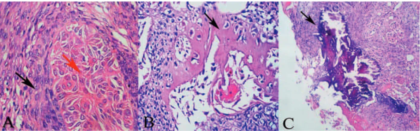Figura 2. Ameloblastoma em cão. A. Aglomerados e folhetos de células epiteliais compostos ao centro por células  de aspecto estrelar (seta vermelha) e perifericamente por células fusiformes dispostas em fileiras em paliçada alinhada  perpendicularmente à m