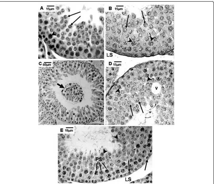 Figure 1 Photomicrographs of testicular sections of Sham Control, Amifostine, Doxorubicin and Amifostine/Doxorubicin treated rats at different ages