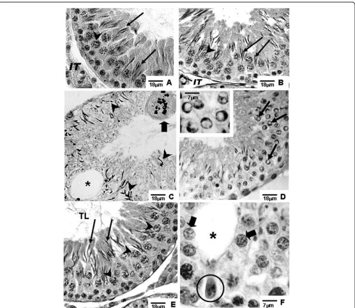 Figure 2 Photomicrographs of testicular sections of Sham Control, Amifostine, Doxorubicin and Amifostine/Doxorubicin treated rats at different ages