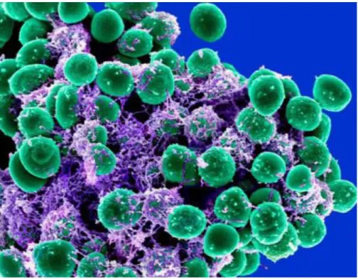 Figure 3: Staphylococcus epidermidis. Photo credit: National Institute of Allergy and Infectious Diseases (NIAID) 