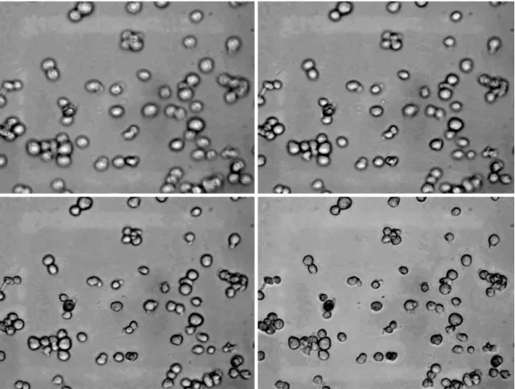 Figure 2.2: Example of an image stack: assay at different focus (from left to right, top to bottom).