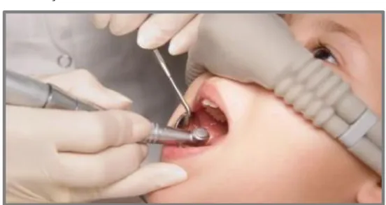 Figura  3:  Recurso  à  sedação  consciente  para  cuidados  dentários  em  crianças  (Fonte: gapski odontologia, 2010)