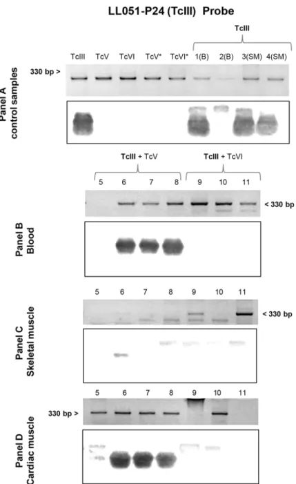 Fig 3. Southern blot analyses using the TcIII (LL051-P24) probe. Each panel shows the electrophoretic pattern of minicircle regions and kDNA transferred to a nylon membrane